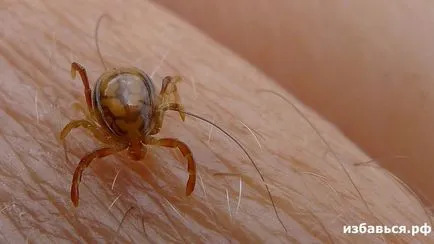 Cum să scapi de căpușa fără ajutorul experților