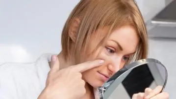 Cum să scapi de acnee roșeață după bani (modul de a elimina roseata dupa stoarcere cosuri) Cum să scapi de acnee roșeață după fonduri