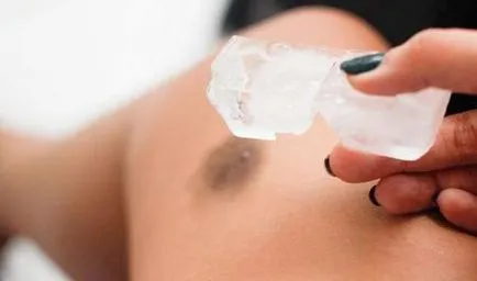 Cum sa scapi de vânătăi pe picioare, capabil să curețe rapid și dezinfecta lor (picioare) Cum sa scapi de vânătăi pe picioare, cum să curețe și să le trateze rapid