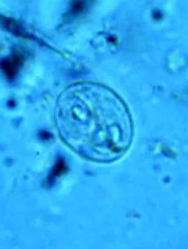 giardia
