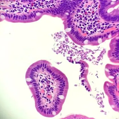 giardia