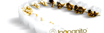 100% -ban