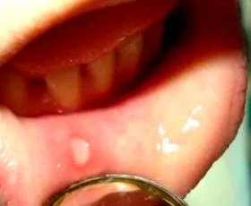 предизвикува предизвикува