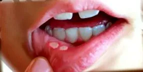 предизвикува предизвикува
