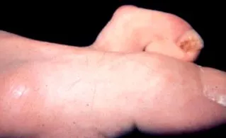apró ízületeinek