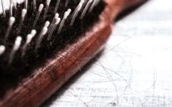 alopecia egészségügyi
