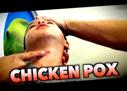 papillómák