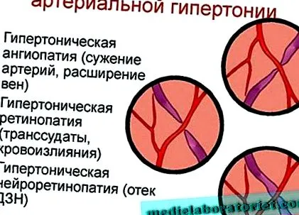kezelése retina
