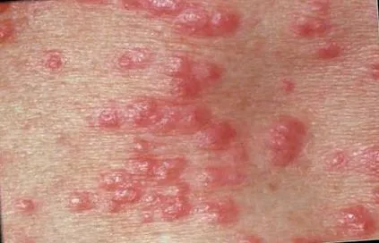 emberi