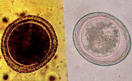 toxocara toxocara