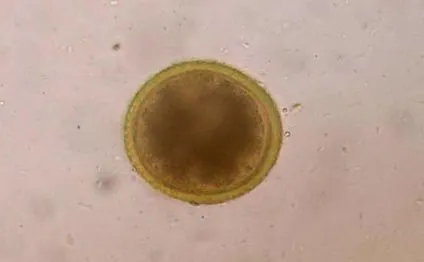 paraziták toxocara