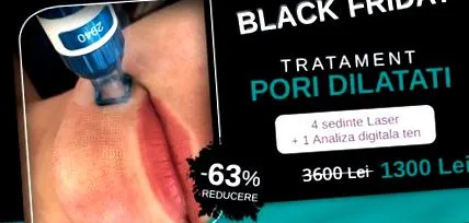 kitágult pórusok yiara