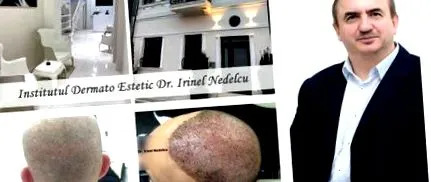 hajhullás