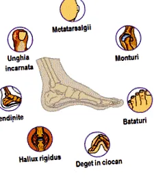 boka duzzanata