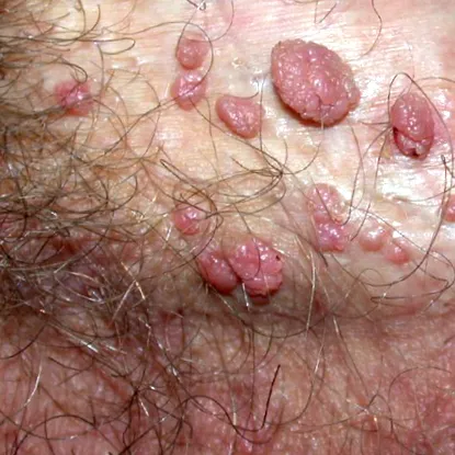 hepatocelluláris