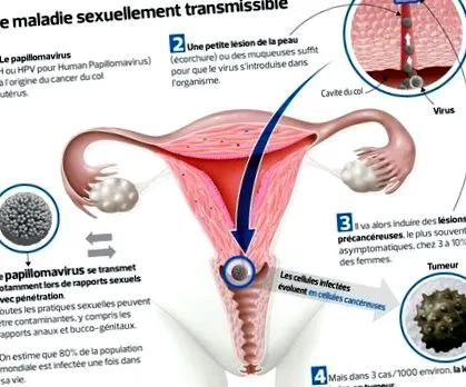 prosztatarák kezelésének urológia