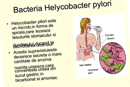 gyomorfekély