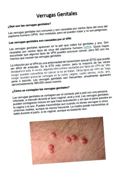 emberi