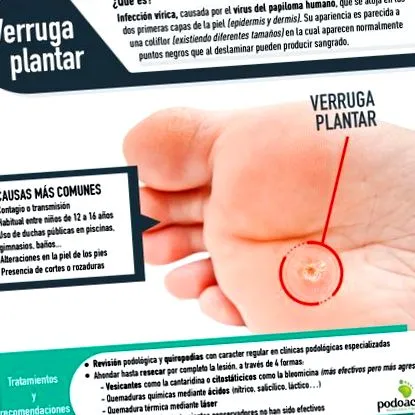 papilloma