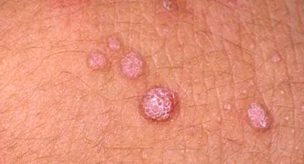 emberi
