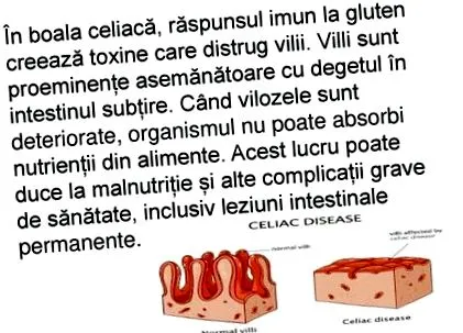 ízületi ízületi fájdalmat