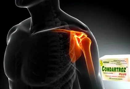 osteoarthritisének crucearosies1
