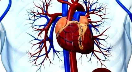 myocarditis