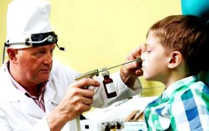 adenoidok