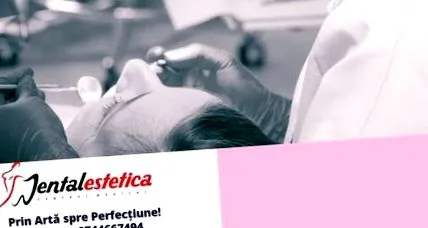 Стоматолошка естетика