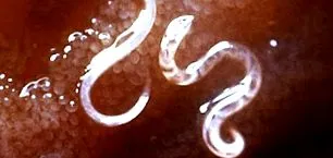 blastocystis