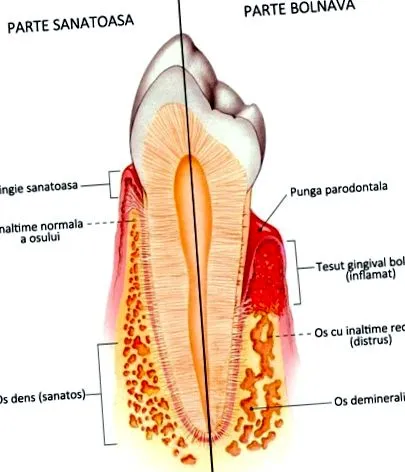periodontalis