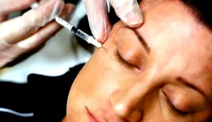 botox