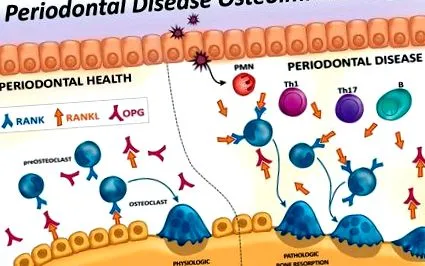 periodontal titkos