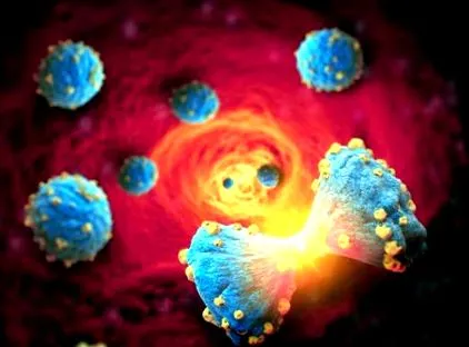 myeloma csontrák