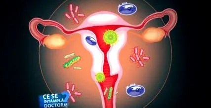 candidiasis