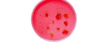 candidiasis