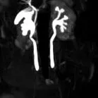 MRI-koronális szakasz