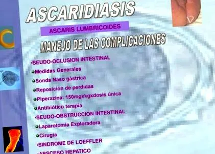 enterobiasis