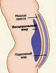 маснотии
