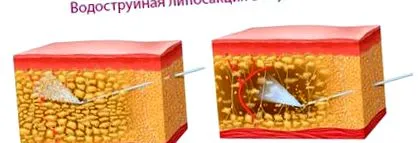 грбот отстранат
