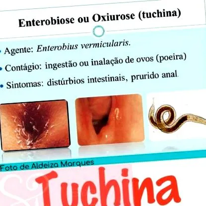 kezelésére ascariasis