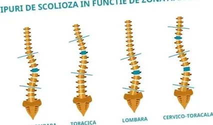 fizioterápiával fizioterápiával