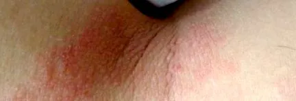 дебелеење