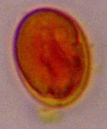 giardia megszabadítja