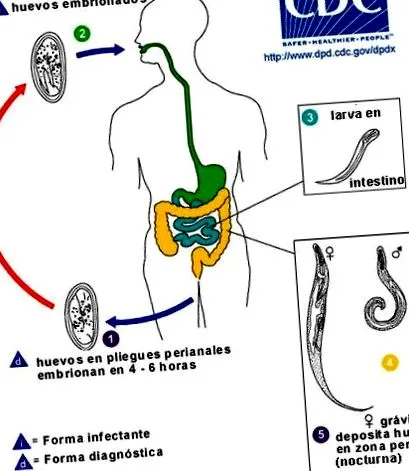 enterobius