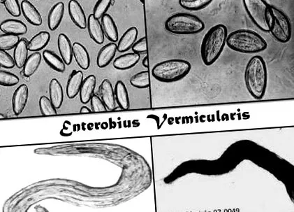 enterobiusvermicularis