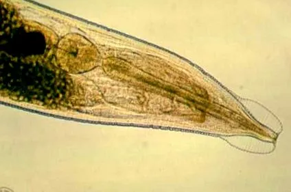 vermicularis