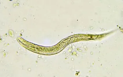vermicularis