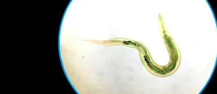 enterobiasis lombrices