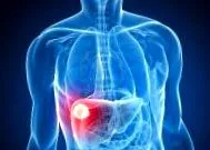 autoimmun hepatitis
